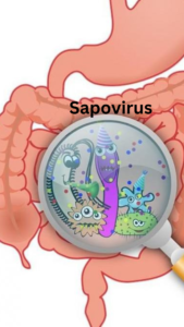 Image showing Virus affecting digestive system